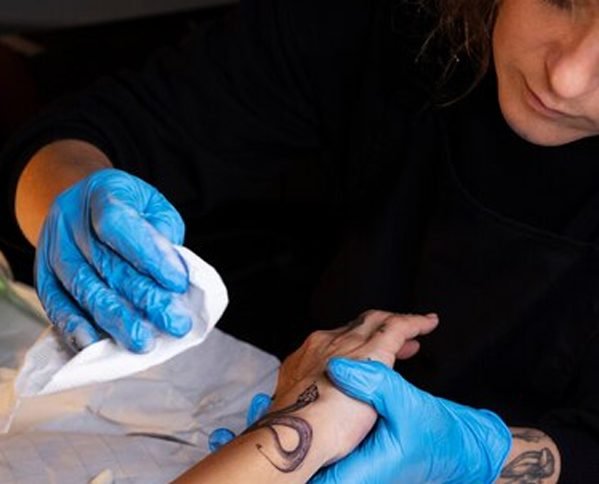 6 Success Factors of Tattoo Removal | Kitagawa Dermatology