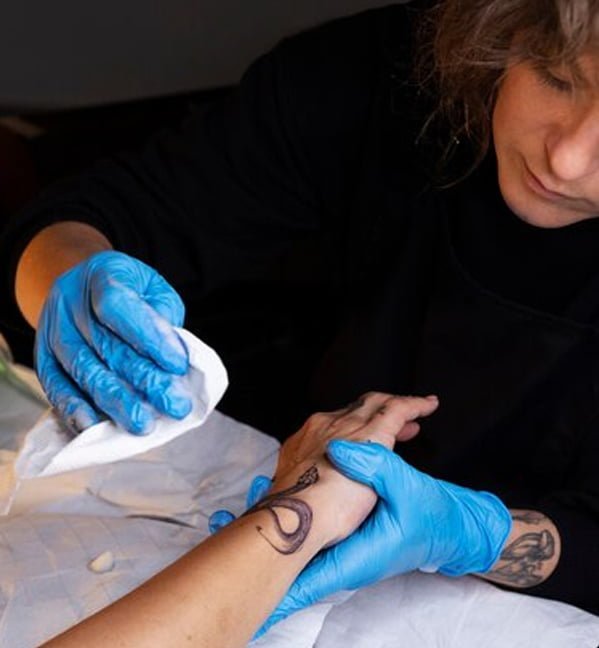 What Is The Best Method For Removing Tattoos? | Oracle Tattoo